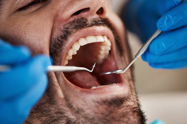 Best Emergency Tooth Extraction in Hershey, PA